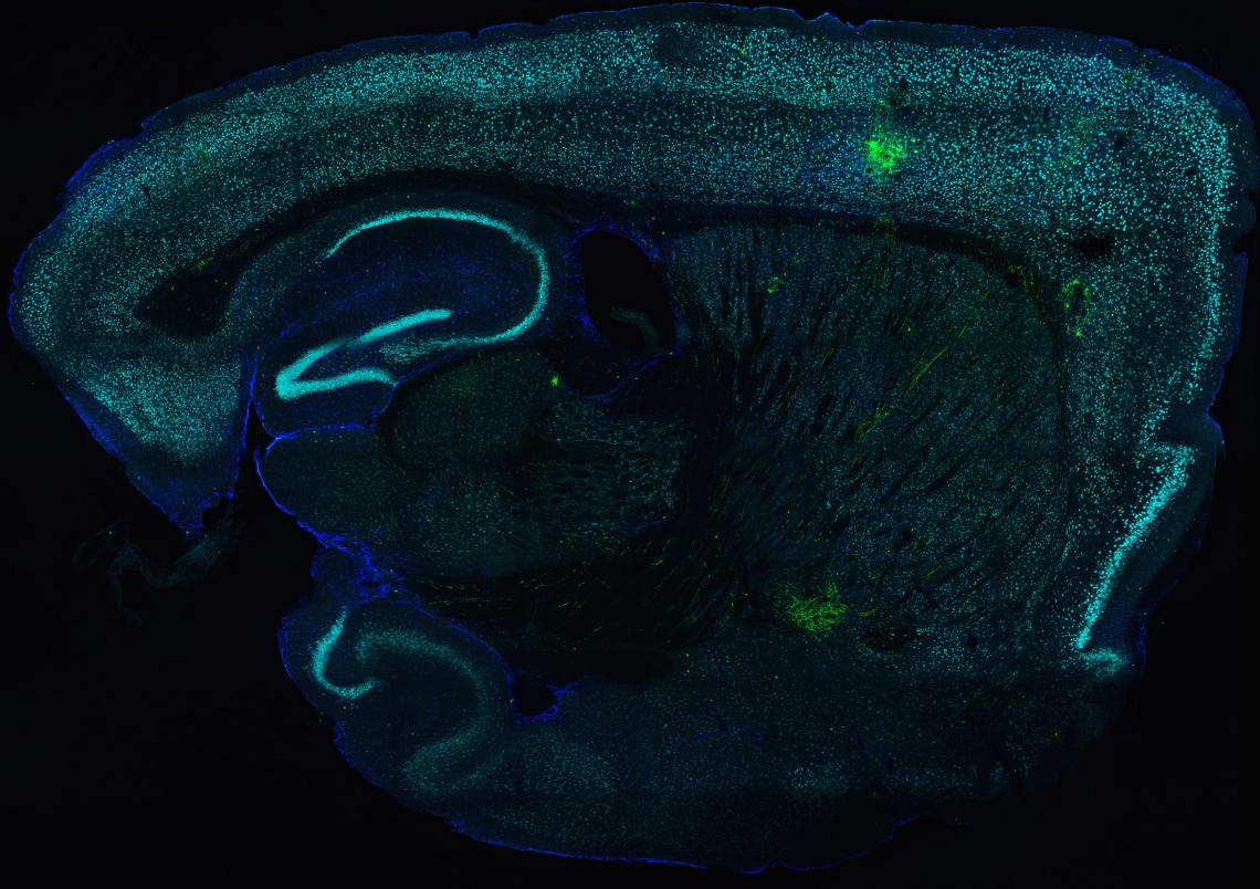 A stitched-grid image of a brain section from a transgenic mouse infected with Toxoplasma-Cre parasites. All green cells have been injected by parasite with parasite-Cre fusion protein, allowing the Koshy lab to track which cells in the brain interact wit A stitched-grid image of a brain section from a transgenic mouse infected with Toxoplasma-Cre parasites. All green cells have been injected by parasite with parasite-Cre fusion protein, allowing the Koshy lab to track which cells in the brain interact wit